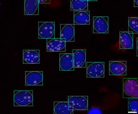 63e3971d3b9e5c80482a4f07_Foci_2 (1)