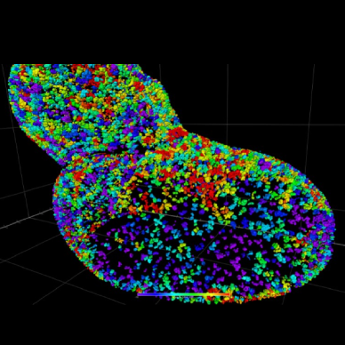 AI Image Analysis for Volume Electron Microscopy