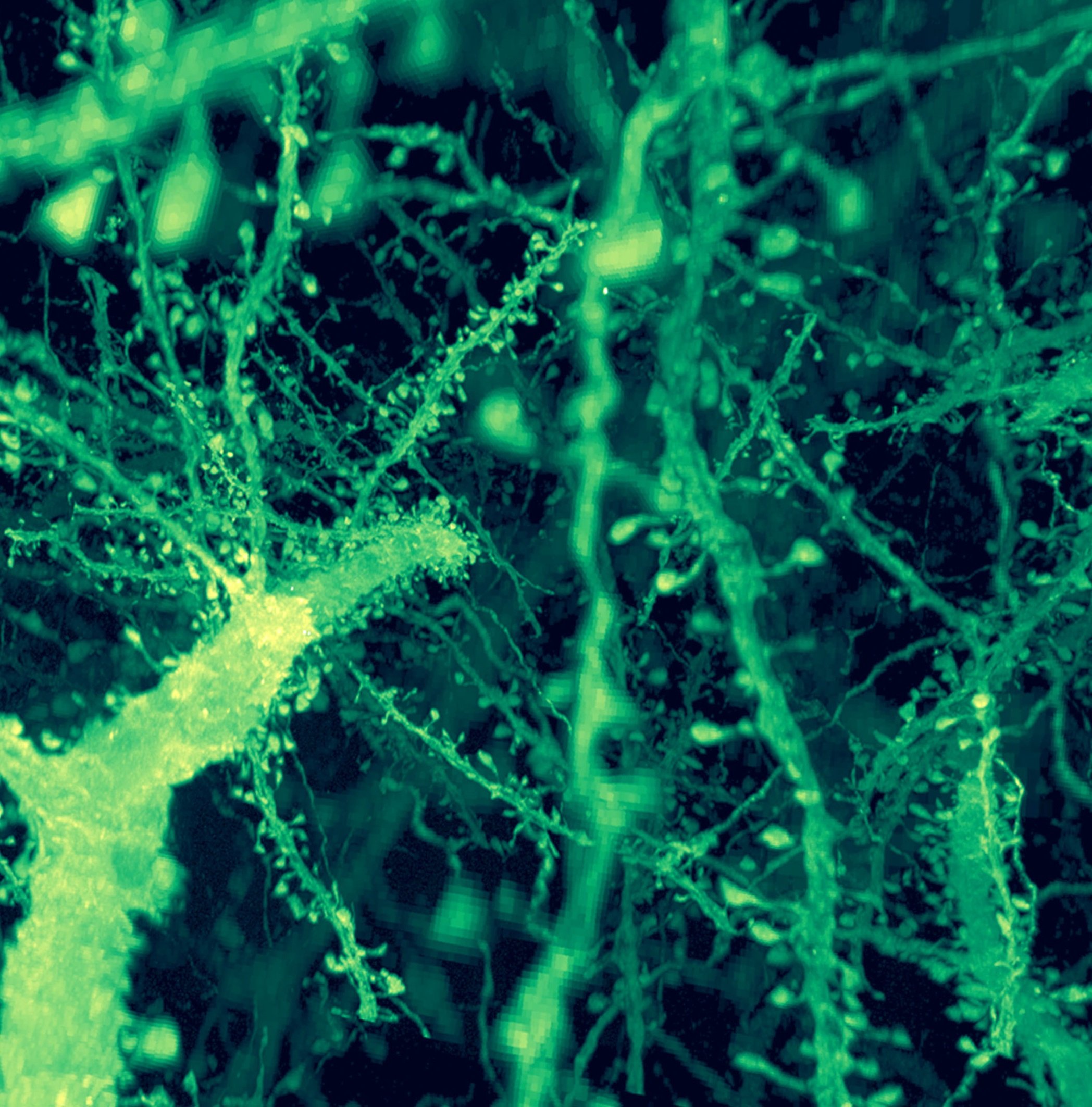 stitching neurons microscopy