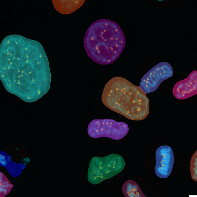 DNA_foci_assay