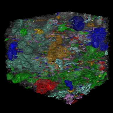 Identify Objects in Electron Microscopy Images