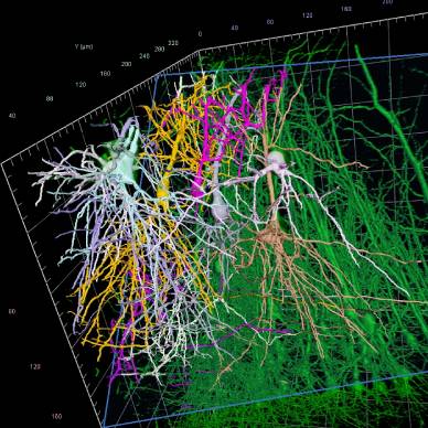 Neuron Tracing