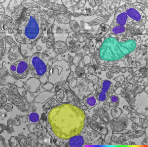 Classifying the mitochondria phenotypes