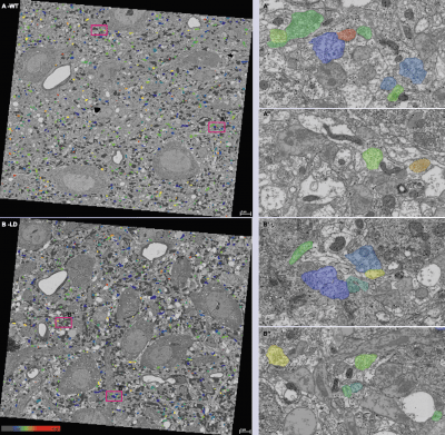 Processing Enabling Rigorous GABA-Post-Embedding Immunogold Quantification15_0-min