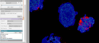 arivisVision4D-colocalization5-min