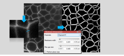 arivisVision4D-membrane-segmenter-investigate-and-enhance-min