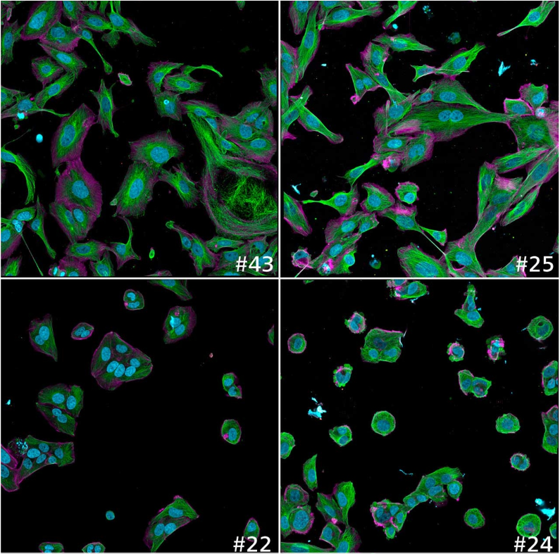 ai-image-analysis-cell-body-sizepng