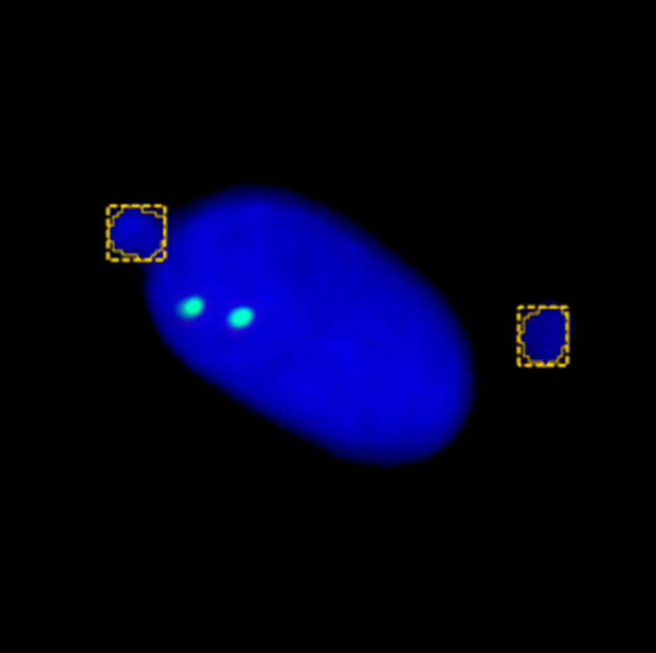 ai-image-analysis-nuclei