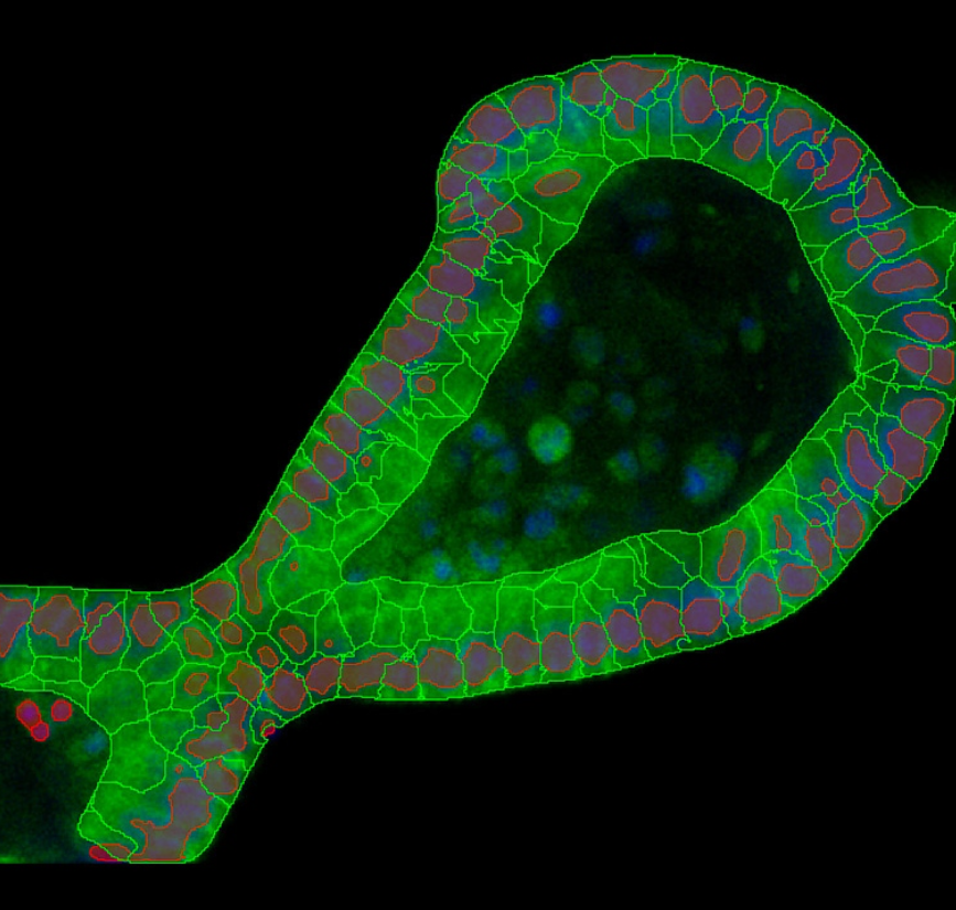 ai-image-analysis-organoid