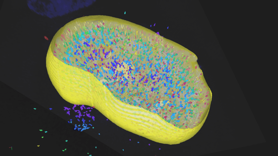 arivis_Distance Measurements_Image data courtesy of Carl Zeiss Microscopy, ZEISS Celldi