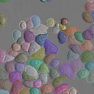 cell_tracking