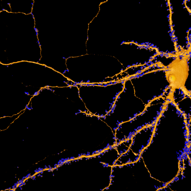 dendritic_spine_analysis