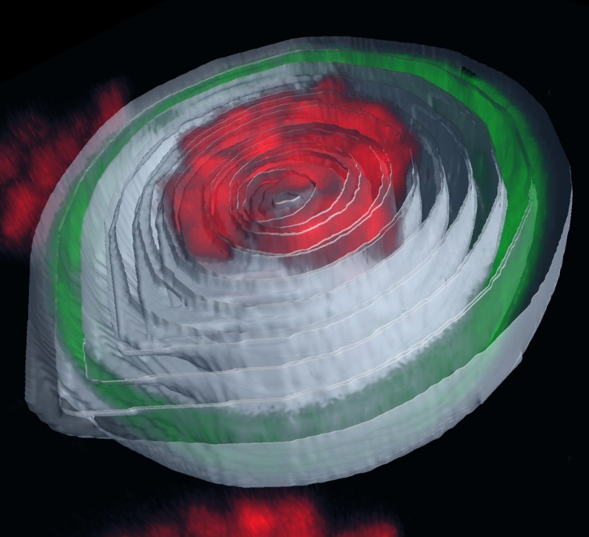 Nucleus, overexpressing lamin C