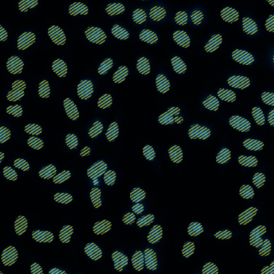 nuclei_counting
