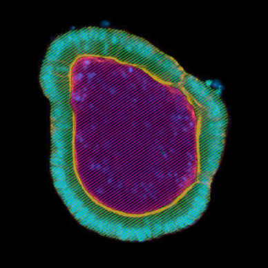 organoid_volume_quantification